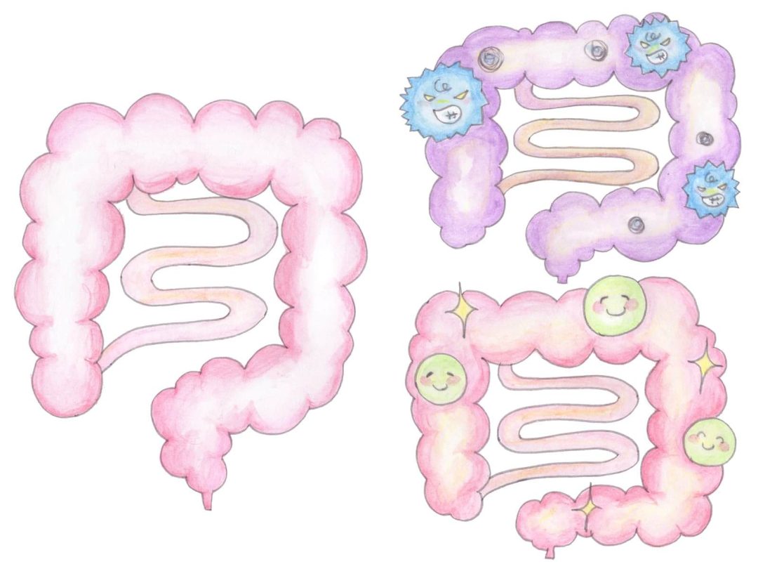 いい腸と悪い腸