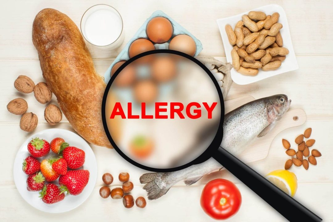 アレルギーの文字と複数の食材
