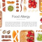 食物アレルギー