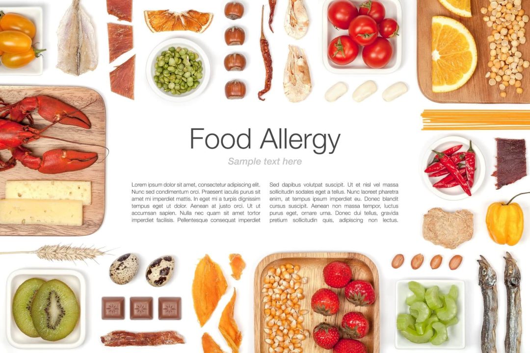食品アレルギーの種類や原因、症状の確認方法の解説。