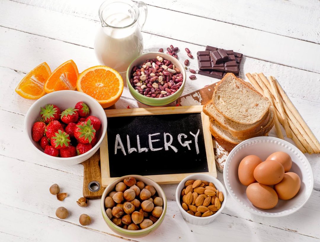 アレルギーの文字と複数の食べ物